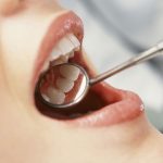 Tooth Cavity Odyssey: Exploring The Most Prevalent Dental Problems